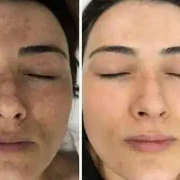 روغن خوراکی