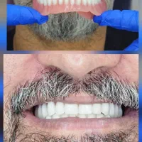 تنها مجموعه تخصصی دندان مصنوعی با حذف واسطه ها