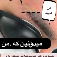 رفع تیرگی بدن حذف تتو صورت و بدن. کربن تراپی