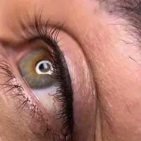 فیبروز ابرو