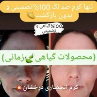 (کرم ضدلک و روشن کننده درخشان)بدون بازگشت|آرایشی، بهداشتی، درمانی|شیراز, قصرالدشت|دیوار