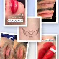 زیبایی طبیعی /درخشندگی/حتی اقایان