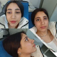 تزریق تخصصی فیلر، بوتاکس، ژل ، مطب زیبایی|خدمات آرایشگری و زیبایی|شیراز, سینما سعدی|دیوار