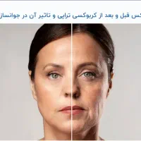 استخدام ادمین حضوری