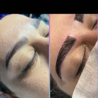 کاشت مو و ابرو