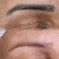 ریموو تخصصی ابرو ،پاک کردن تتوهای قدیمی و بدرنگ