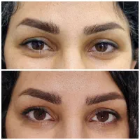 زیبایی به سبک علمی و نچرال توسط پزشک