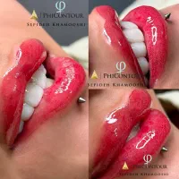 فرصت ویژه برای سه نفر شیدینگ لب|خدمات آرایشگری و زیبایی|کرج, گوهردشت|دیوار