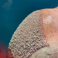 کاشت مو|خدمات آرایشگری و زیبایی|رشت, کاکتوس|دیوار