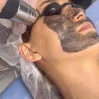 پاک کردن تاتو توسط پزشک