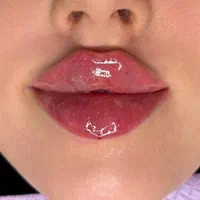 تزریق ژل فیلر بوتاکس مزو و لیزر در کلینیک زیبایی|خدمات آرایشگری و زیبایی|رباطکریم, رباطکریم|دیوار