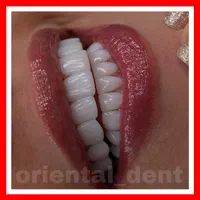 دندانپزشکی/کامپوزیت دندان/ترمیم/روکش/عصبکشی|خدمات آرایشگری و زیبایی|تهران, تهرانپارس شرقی|دیوار