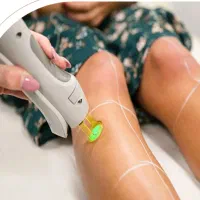 به یک اپراتور لیزر خانم نیازمندیم
