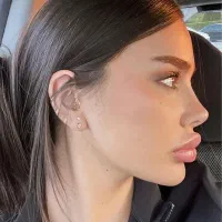 جراحی بینی با طراحی اختصاصی متناسب با چهره شما