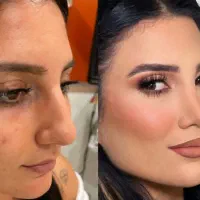 اخرین فرصت عمل بینی عیدانه نیمرخ