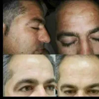 کرم معجزه اصل با کیفیت|آرایشی، بهداشتی، درمانی|تربت‌حیدریه, کلاته توکلی|دیوار