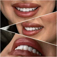 با روزی ۱۰۰ هزار تومن دندونتو ایمپلنت کن|خدمات آرایشگری و زیبایی|تبریز, |دیوار