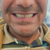 دندان مصنوعی  ( تمام چک )|آرایشی، بهداشتی، درمانی|پارس‌آباد, |دیوار