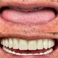 مرکزفوق تخصصی ایمپلنت دیجیتال/یکروزه/سبک کاخ لبخند