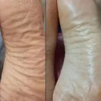 فیشیال اقتصادی،کاراز ما قیمت باشما|خدمات زیبایی و سلامت|اهواز, بهارستان|دیوار