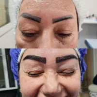 کاشت ابرو دائمی/جراحی پلک(بلفاروپلاستی)|خدمات آرایشگری و زیبایی|تهران, پونک|دیوار