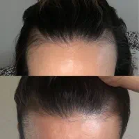 موهای طبیعی دیگه آرزو نیست