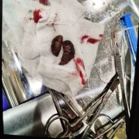 مرکز جراحی لابیاپلاستی و واژینوپلاستی