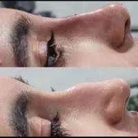 کلینیک تزریق ژل و بوتاکس .فیلر زیر چشم . آنزیم|خدمات آرایشگری و زیبایی|کرج, گوهردشت|دیوار