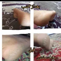 کرمات تصمینی|آرایشی، بهداشتی، درمانی|سوسنگرد, |دیوار