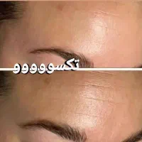 چین چروک تکسوو|آرایشی، بهداشتی، درمانی|شیراز, شاهچراغ|دیوار
