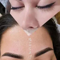 میکرو بلید شیدینگ فیبروز