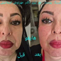 کلینیک پوست ، مو ، لیزر دکتر مهرنوش اسماعیلی