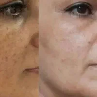 مشاوره تخصصی پوست|خدمات زیبایی و سلامت|تهران, پارک شهر|دیوار
