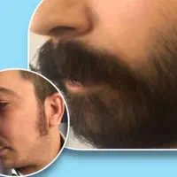 کاشت مو درکلینیک مجوزدار و پزشک متخصص با چک صیادی|خدمات آرایشگری و زیبایی|تهران, سعادت‌آباد|دیوار