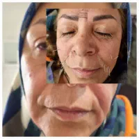 طب سوزنی، بوتاکس، آموزش، مزوتراپی، پلاسماتراپی|خدمات آرایشگری و زیبایی|مشهد, حسابی جنوبی (شهرک غرب)|دیوار
