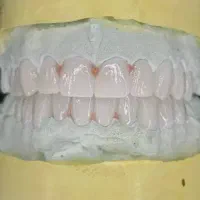 آموزش دندانسازی