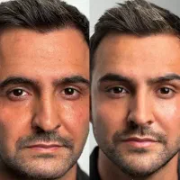 اموزش ژل و بوتاکس در نوبهار اکادمی سهرابی|خدمات آموزشی|کرمانشاه, |دیوار