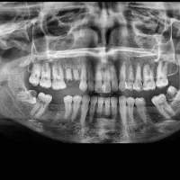 دندانپزشکی