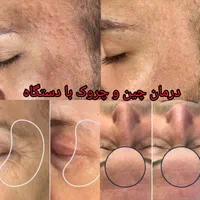 لاغری ،سمزدایی بدن،پاکسازی پوست
