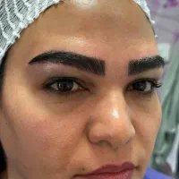 کاشت ابرو اقساطی
