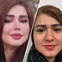 جشنواره عمل زیبایی بینی توسط متخصص نوبت فوری|خدمات آرایشگری و زیبایی|اهواز, کیانپارس |دیوار