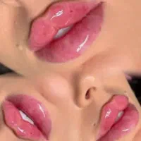 جشنواره ویژه فیلر لب فول فیس زاویه فک،گونه،چونه و.|خدمات آرایشگری و زیبایی|مشهد, شهید فرامرز عباسی|دیوار