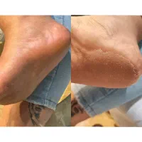 خودم پدیکوریست هستم|استخدام درمانی، زیبایی، بهداشتی|رشت, انصاری|دیوار