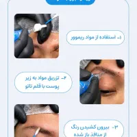 ریمو