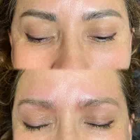 پاک کردن تتو ابرو، بدن با جدیدترین دستگاه امریکایی|خدمات آرایشگری و زیبایی|آمل, |دیوار