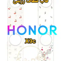 گارد Honor X9c 5G /قاب /گلس لبه خم /هونور /محافظ|لوازم جانبی موبایل و تبلت|یزد, |دیوار
