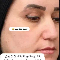 کرم معجزه شب|آرایشی، بهداشتی، درمانی|بندر گز, |دیوار