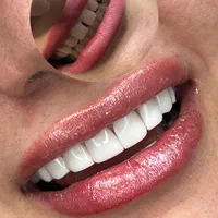 کامپوزیت دندان ،لمینت،بلیچینگ (آف بهاری)|خدمات آرایشگری و زیبایی|اصفهان, خانه اصفهان|دیوار
