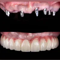 دندانپزشکی اقساطی بدون بهره|خدمات آرایشگری و زیبایی|کرج, کوی کارمندان شمالی|دیوار