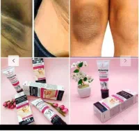 سفید کننده قطعی نقاط حساس بدن|آرایشی، بهداشتی، درمانی|قوچان, |دیوار